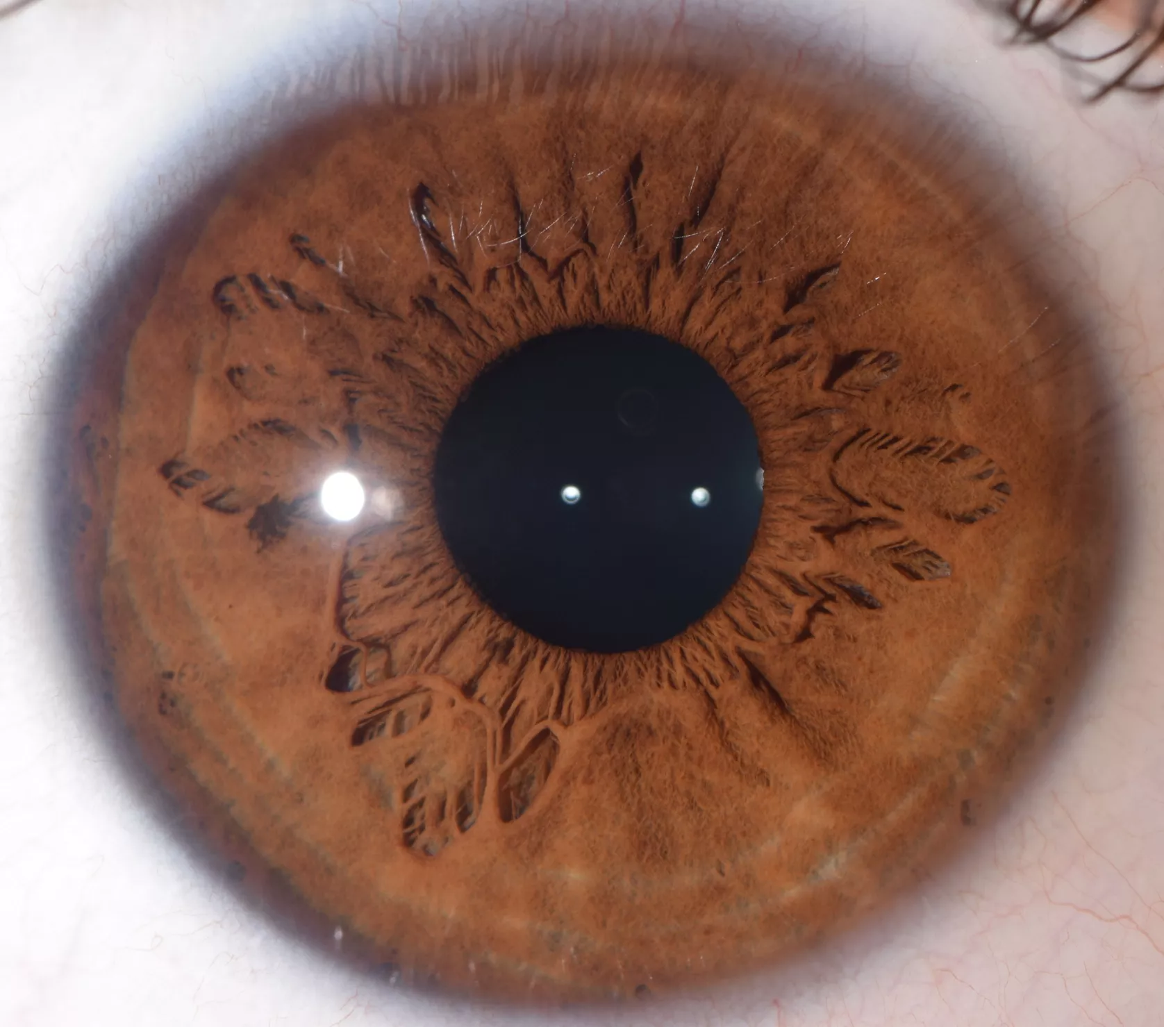 iridologia 1