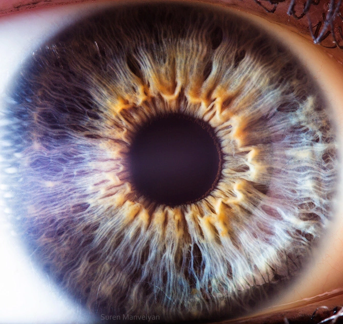 iridologia 3