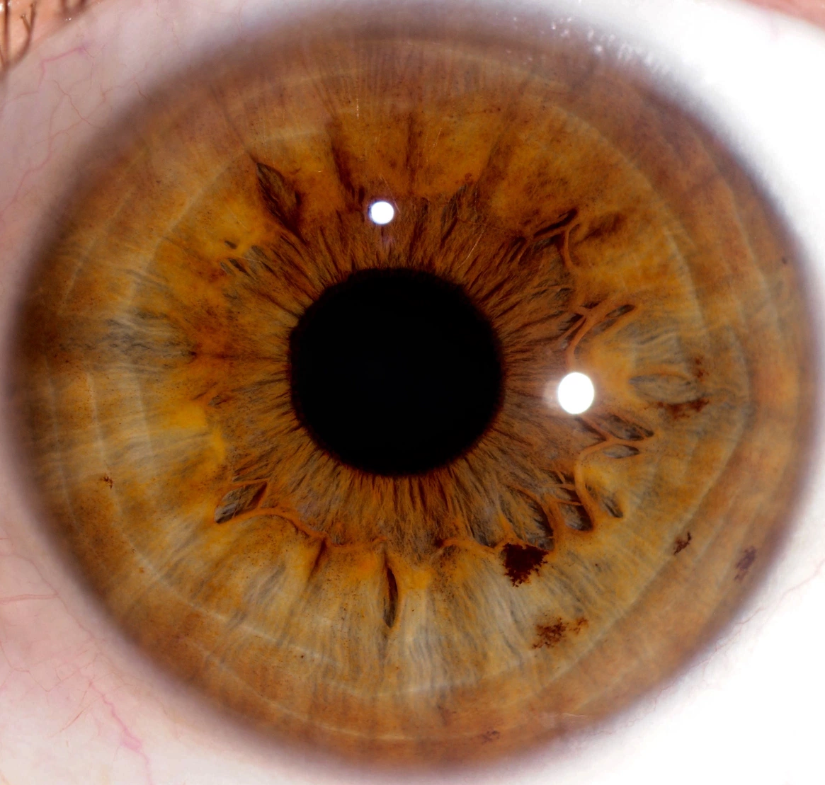 iridologia 4