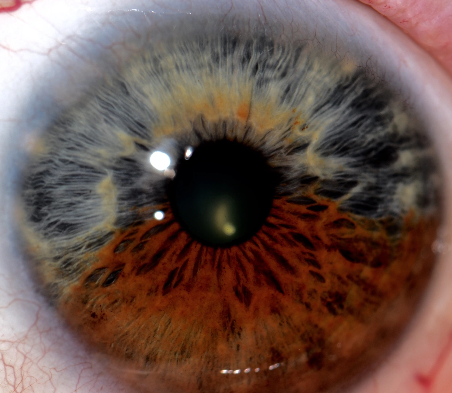 iridologia 6