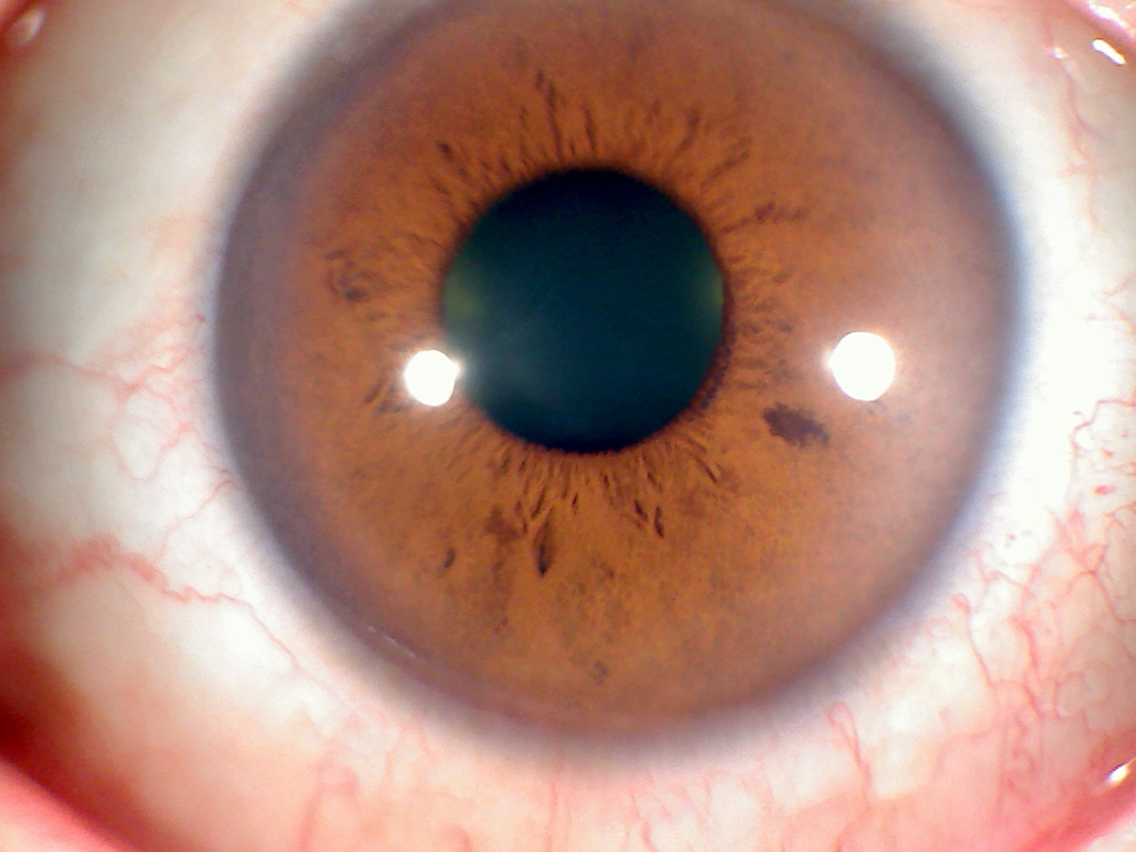 iridologia 7