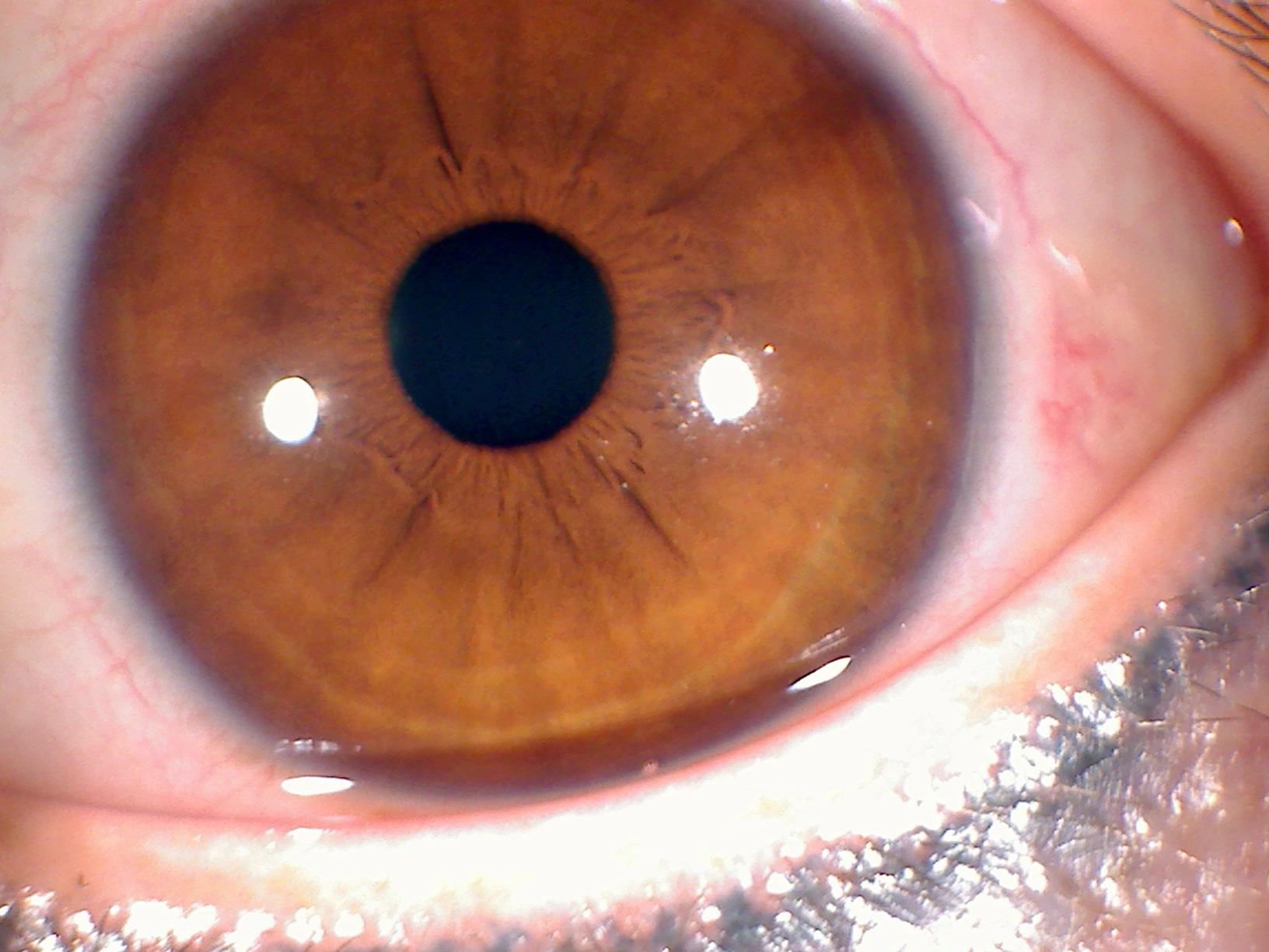 iridologia 8