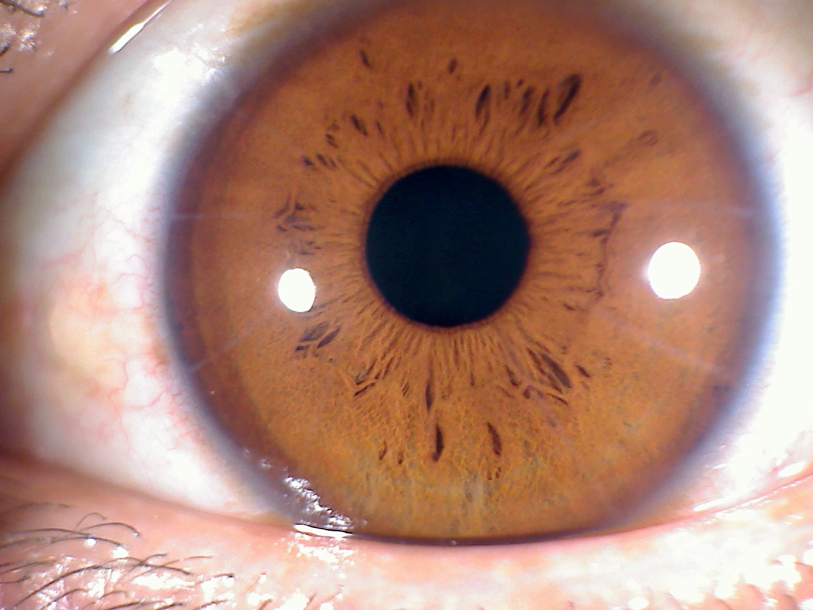 iridologia 9