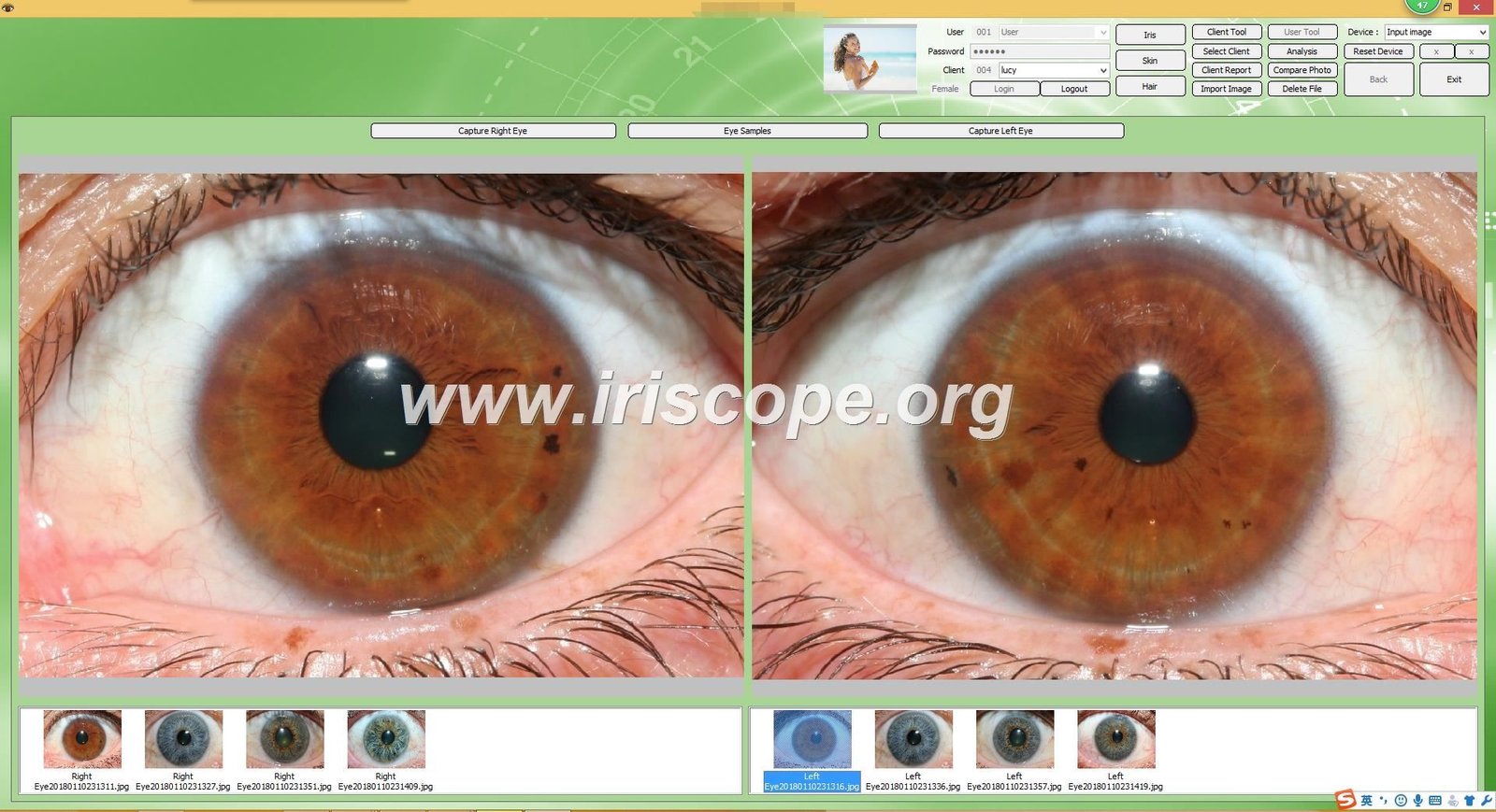 Iridoscopia Digital Computarizada