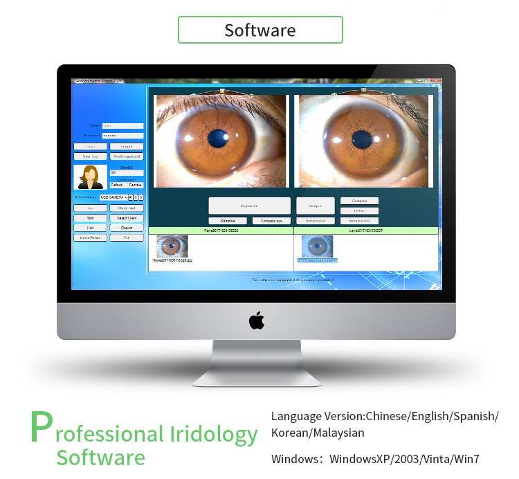 software Aparato de iridología
