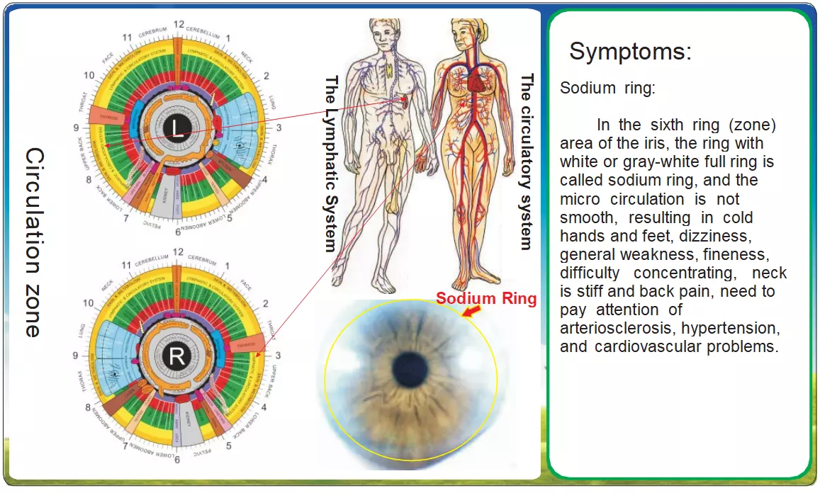 8.3 Iridología y Salud Circulatoria: Señales Oculares de Desequilibrios Sistémicos
