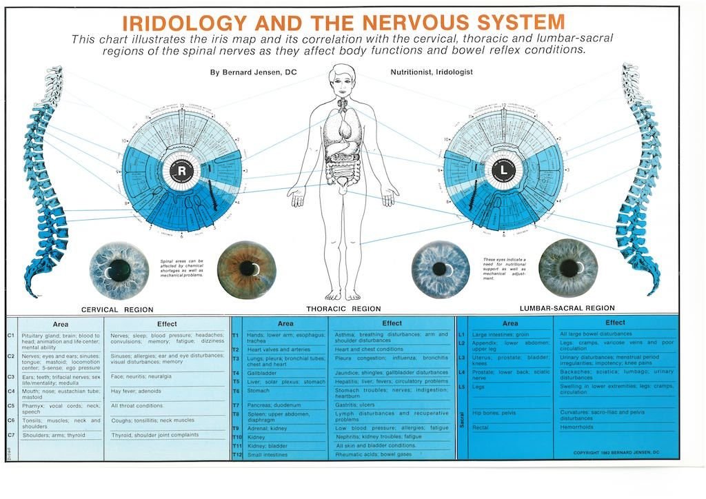 iridologia mappa