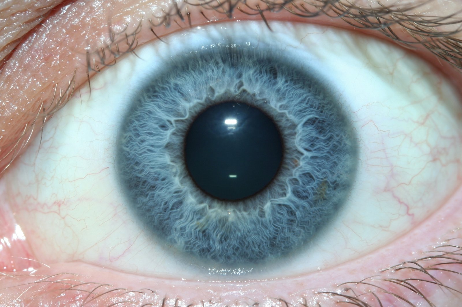 Absorción Iridología