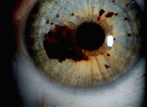 IRIDOLOGY