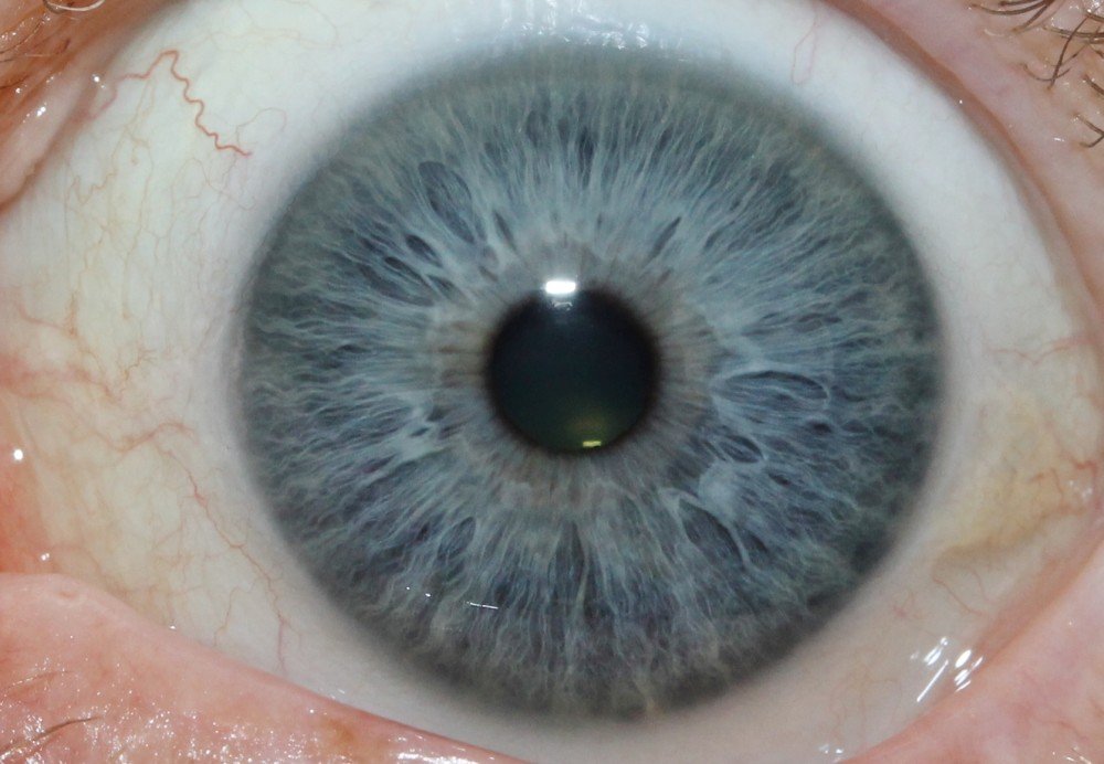 IRIDOLOGY