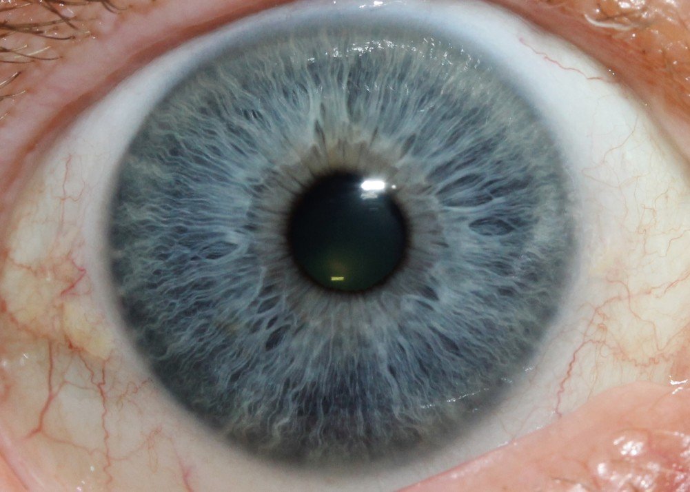 IRIDOLOGY