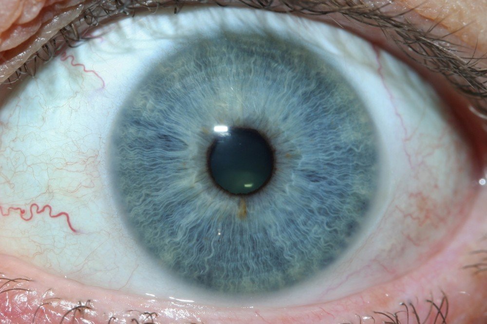 IRIDOLOGY