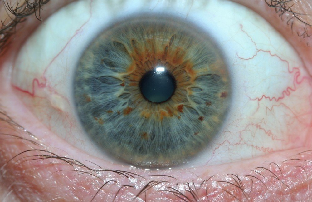 IRIDOLOGY