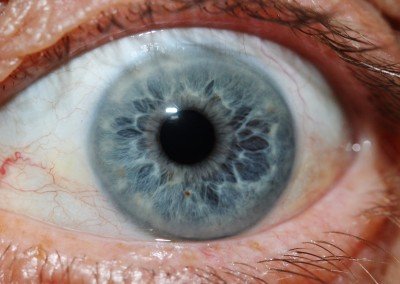 IRIDOLOGY