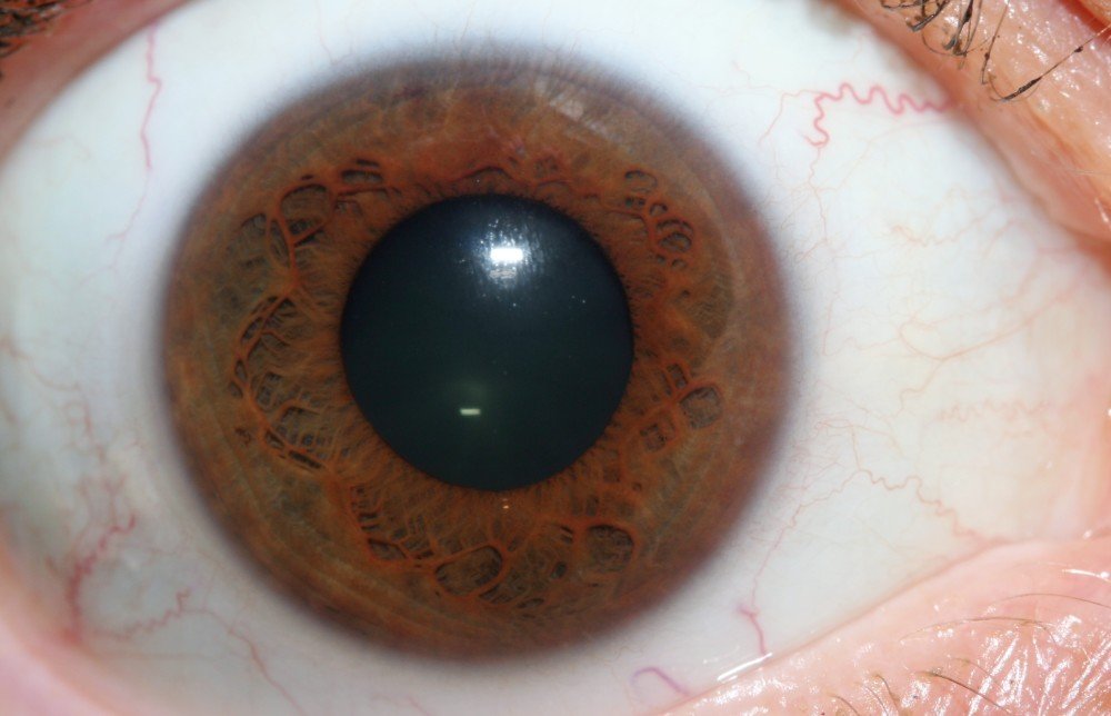 IRIDOLOGY