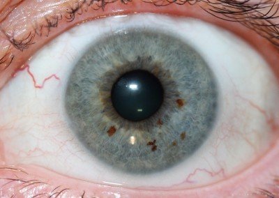 IRIDOLOGY