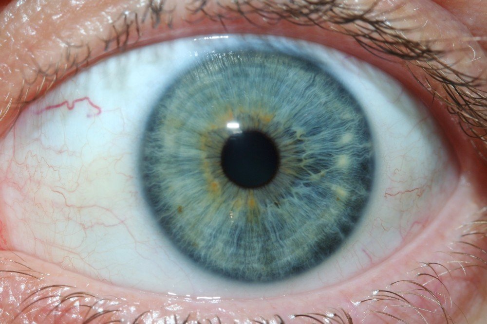 IRIDOLOGY