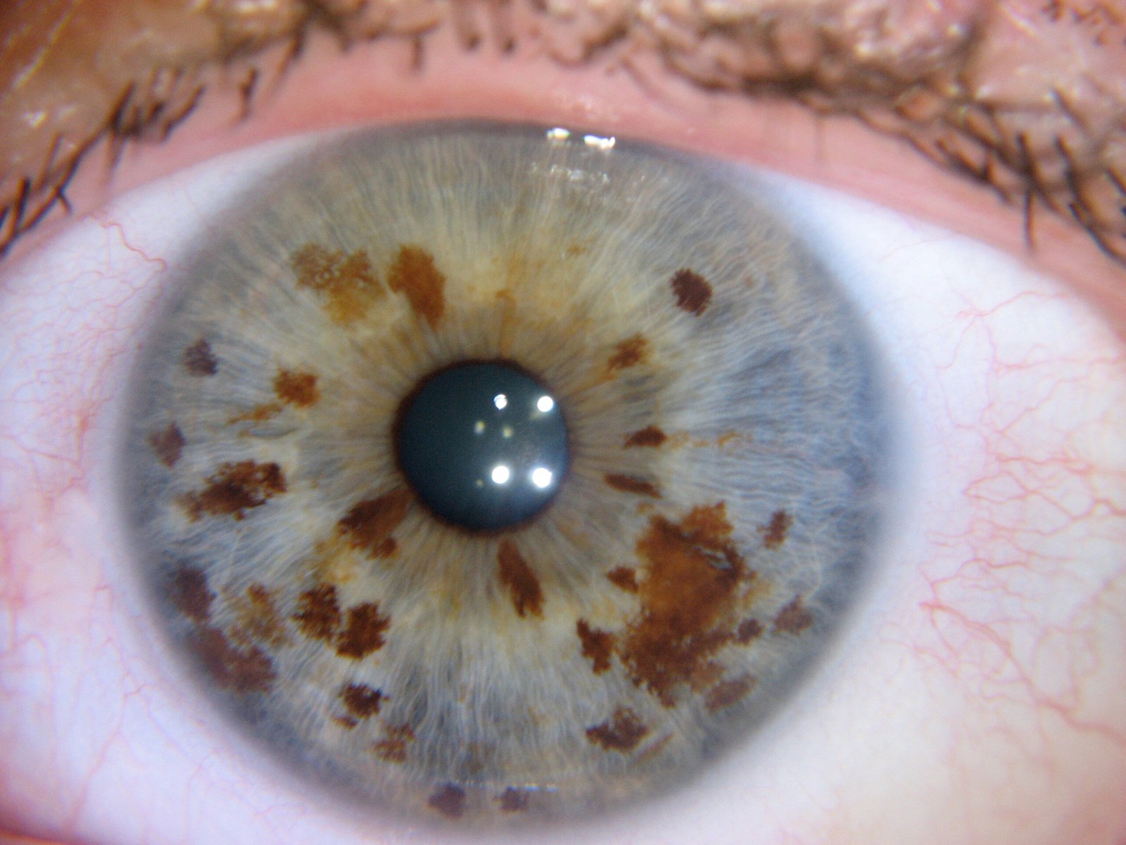 MAIKONG IRIDOLOGY