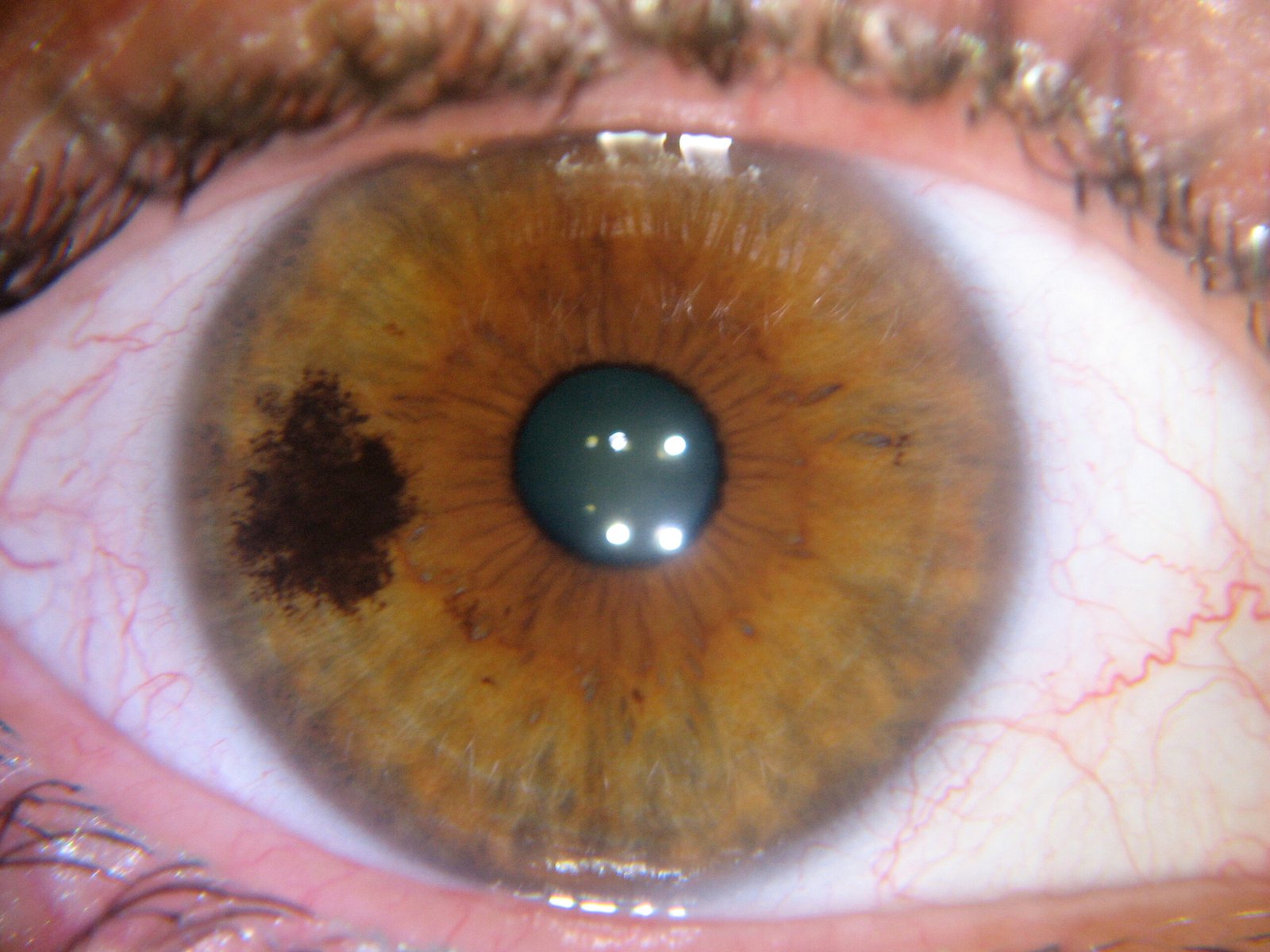 IRIDOLOGY